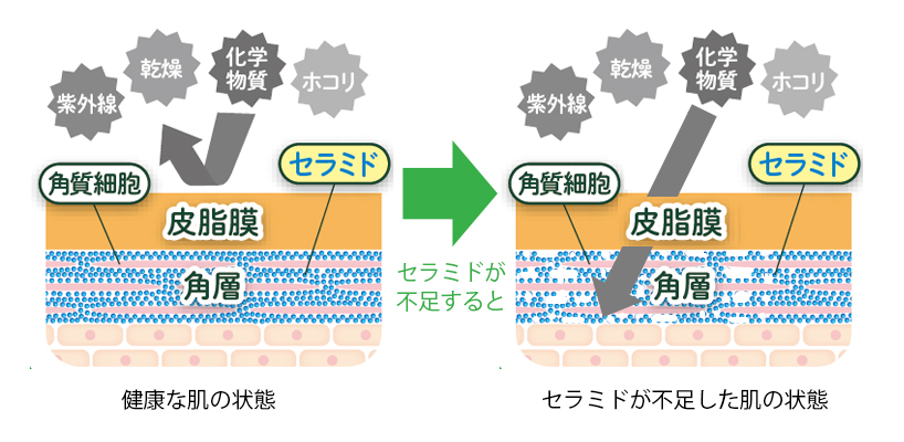 セラミド