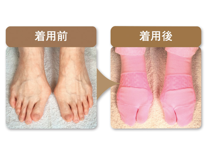 予約 外反母趾対策靴下 婦人用 ブラック 有機野菜や自然食品の購入は大地を守る会のお買い物サイト