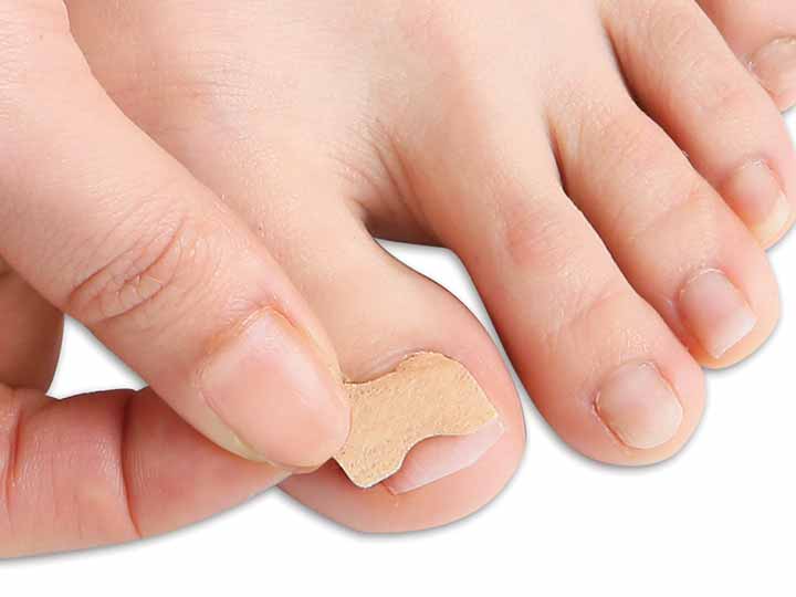 予約　簡単貼るだけ　Ｄｒ巻き爪テープ60枚_2